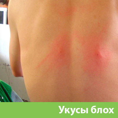 Укусы блох в Орехово-Зуево