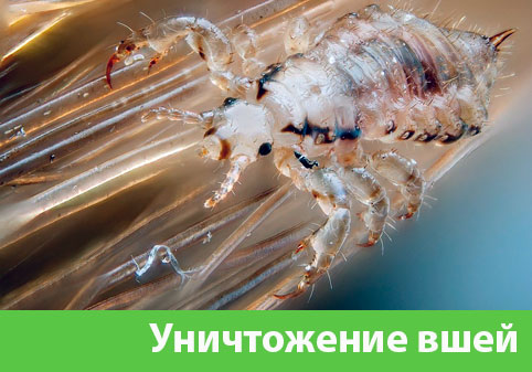 Уничтожение вшей в городе Орехово-Зуево